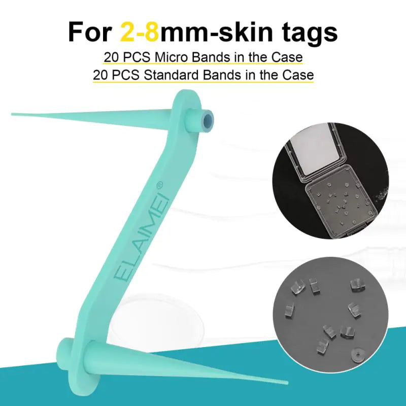 BoldShoppery™ Skin Tag Remover Kit