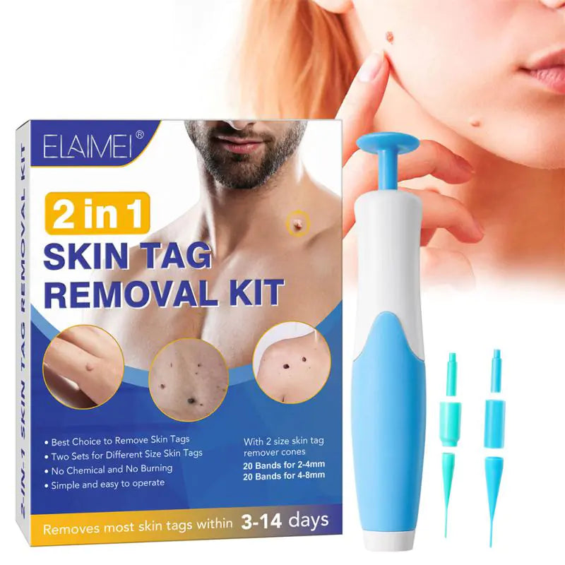 BoldShoppery™ Skin Tag Remover Kit